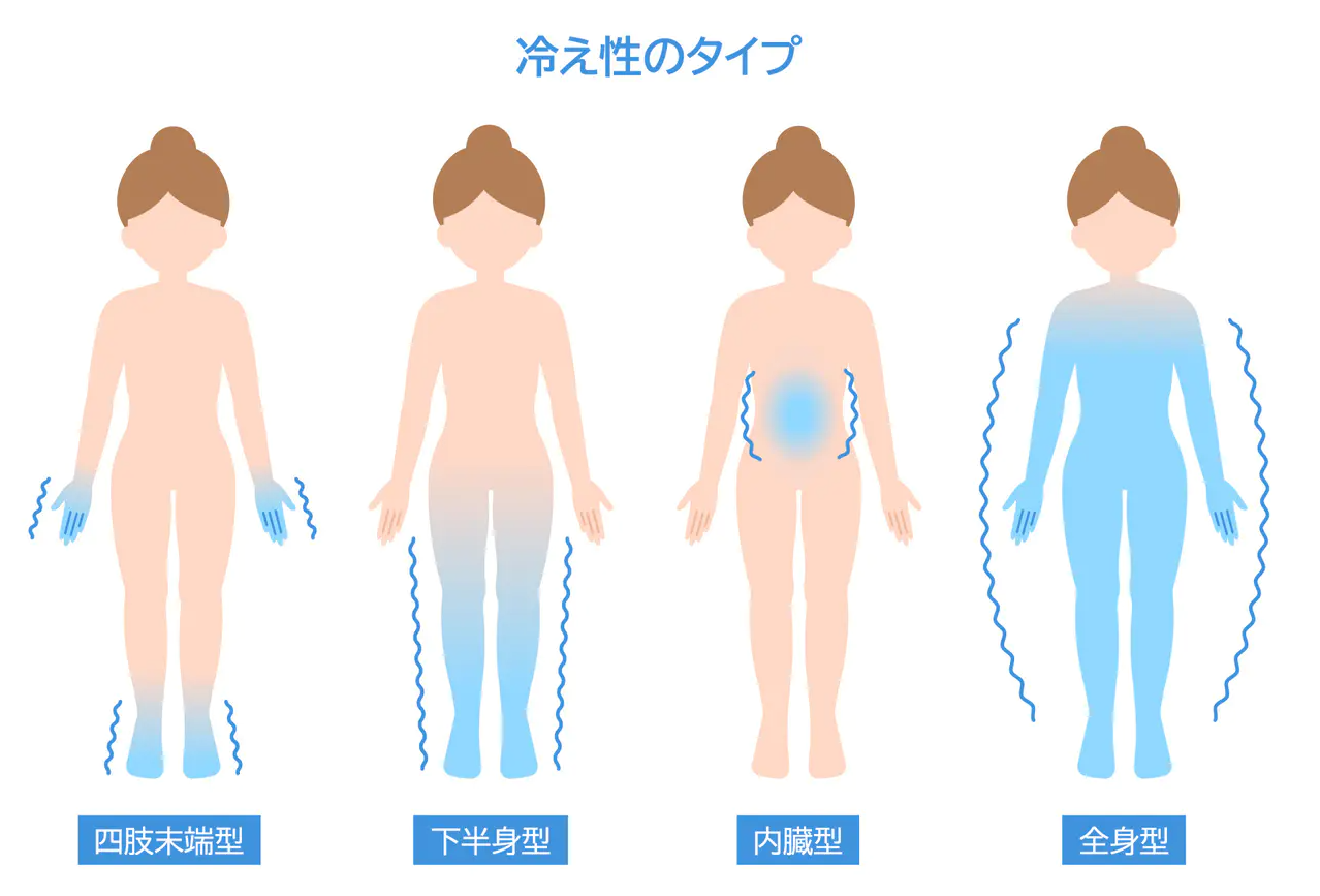 大阪　高槻　橋本鍼灸整骨院　冷え症