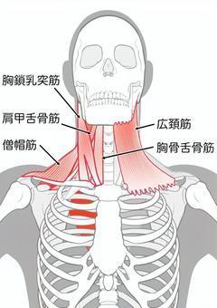 高槻　寝違い　首の痛み　胸鎖乳突筋　橋本鍼灸整骨院　保険治療