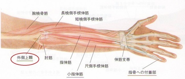 高槻　テニス肘　肘の痛み