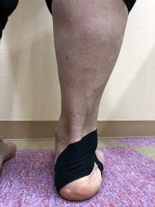 外反拇趾　有松絞り　黒地 外反母趾 サポーター【外反母趾 保護 クッション ソックス 2足